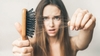 Rụng tóc bao nhiêu là bình thường? Làm thế nào để ngăn ngừa?