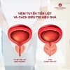 Viêm Tuyến Tiền Liệt Và Cách Điều Trị Hiệu Quả - Nutri Prostate Support