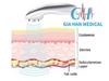 Siêu âm trị liệu và quá trình <br>chữa lành Mô