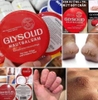 Kem chống nẻ Glysolid