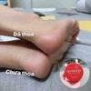 Kem chống nẻ Glysolid