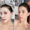 Mặt nạ dưỡng trắng, chống lão hóa Derm-All Matrix Mask 35g ( có VAT )