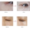 Kem dưỡng mắt mờ thâm cuồng, giảm nhăn, chống lão hóa Clapiel Rich Eye Cream 30g