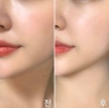 Tinh Chất Phục Hồi Khỏe Da Chiết Xuất Từ Tinh Dầu Lá Bách Xanh Đảo Jeju Pyunabek Leaf Essence Dr.pepti