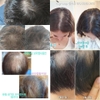 Set dầu gội+ xả chống rụng tóc, phục hồi tóc hư tổn Botalab của Incellderm (date 8.7.2023)