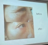 Bộ sản phẩm chức năng kép giúp trẻ hoá tái sinh, giảm nếp nhăn, làm trắng da Cell Fuller (có VAT)