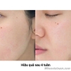 Tinh Chất Phục Hồi, Tái Sinh, làm sáng da Whoo Illuminating Regenerating Essence 8ml