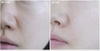 Tinh chất trị mụn, xử lý bã nhờn, thu nhỏ lỗ chân lông, mờ thâm Paula's Choice Clinical Niacinamide 20% Treatment