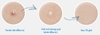 Miếng dán mụn thần kỳ giảm viêm mụn, giảm sưng Brown Lab Dr.dreamderm Spot Patch