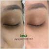 Kem đặc trị nám, phân giải sắc tố Meline 02 Caucasian Skin Night