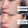 Peel tái tạo da chuyên sâu, cho da mụn nám tàn nhang và LCL to CNP Rx Skin Rejuvenating Intensive Peel 2ml 