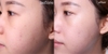 Tinh chất trị mụn, xử lý bã nhờn, thu nhỏ lỗ chân lông, mờ thâm Paula's Choice Clinical Niacinamide 20% Treatment
