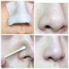 Ủ Mũi Xử Lý Mụn Removes Blackheads