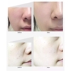 Kem Dưỡng Da Nâng Cơ, Ngăn Ngừa Lão Hóa Medi-Peel Bor-Tox Peptide Cream