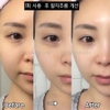 Kem Dưỡng Da Nâng Cơ, Ngăn Ngừa Lão Hóa Medi-Peel Bor-Tox Peptide Cream