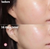 Tinh Chất Làm Trắng Chống Nhăn Ciracle Hydra B5 Source Wrinkle 30ml
