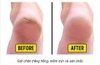 Kem dưỡng và trị nứt gót chân Hàn Quốc Foot Care Cream 60g