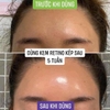 Kem Retinol Chống Lão Hóa, Sáng Da Charmzone DeAge Retinol Pro Refine Cream 50ml