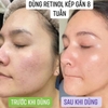 Kem Retinol Chống Lão Hóa, Sáng Da Charmzone DeAge Retinol Pro Refine Cream 50ml