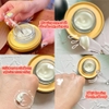 Kem trị nám cao cấp Dongsung Rannce Cream.