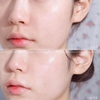 Mặt Nạ Dưỡng Da Mediheal Essential Mask