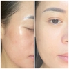 Serum tế bào gốc tái tạo làm trắng da SkinClinic P.R.P 30ml
