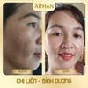 Bộ kem dưỡng AiThan hỗ trợ cải thiện nám chuyên sâu