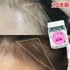 Viên BIOTIN Mọc, Khoẻ Tóc H & B Biotin 1000µg
