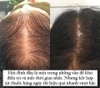 Xịt mọc tóc, ngừa rụng tóc Minoxidil 2% Bailleul 60ml