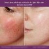Serum tế bào gốc tái tạo làm trắng da SkinClinic P.R.P 30ml