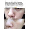 Serum Trị Nám Làm Trắng Da Caudalie Vinoperfect 30ml
