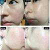 Tinh Chất Phục Hồi, Cấp Ẩm Da EPI-RX B5.5 Advanced Repairing Gel 30ml
