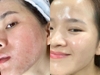 Kem K Phục hồi làm khoẻ da Skin Repair 60g