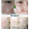 Kem trái nhàu trắng mịn giảm mụn, liền sẹo, thải độc tố Medi peel Cica Antio cream