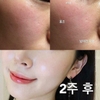 Serum Tái Tạo Phục Hồi Da Red Peel Tingle