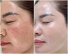 Kem dưỡng trắng đặc Trị Nám,Tàn Nhang Melasma-X 3D Whitening Clinic Renewal Cream