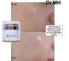 Kem nám Mela M Whitening magic cream - Mẫu mới của dòng kem nám Mela Q