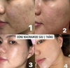 Serum Niacinamide 20% sáng da, thu nhỏ lỗ chân lông Evenswiss 30ml (hàng công ty)