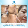Tinh chất giảm thâm, ức chế giảm sắc tố nám Doclab Extreme Whitening Ex13 Ampoule 50ml (có VAT)