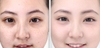 Kem ENCOS Arbutin 5% Cream Trị Nám, Tàn Nhang 15ml Hàn Quốc