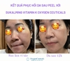 Set phục hồi da sau Phẫu thuật Thẩm Mỹ, Laze,Tiêm, Lăn phi kim, Vi tảo Sukalming Derma Kit