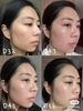 Kem tretinoin tái tạo hỗ trợ trị mụn, mờ nám Abdi Ibrahim Acnelyse Krem Tretinoin % 0.1