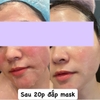 Mặt Nạ Làm Dịu, Phục hồi giảm đỏ Skin Lab Glass Skin Aquaring Mask 