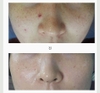 Tế bào gốc làm trắng và nâng cơ BQ CELL Re Cell Cure Ampoule.