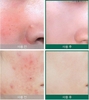 Kem Dưỡng Trị Mụn Some By Mi AHA-BHA-PHA 30 Days Miracle Cream.