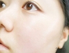 Tinh Chất Tế Bào Gốc Eldas Aura Shine Gold Pearl Premium Peptide All In One.