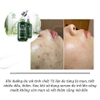 Serum Ngừa Mụn, Kháng Viêm Điều Tiết Bã Nhờn Histolab 72% Azulene Complex Ampoule Derma Science
