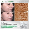 Kem đặc trị nám, phân giải sắc tố Meline 02 Caucasian Skin Night