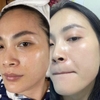 Kem Dưỡng Sáng Da, Giảm Thâm Nám Angel's Liquid Tranexamic Mela Zero Cream 50ml