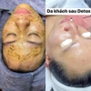 Peel làm sạch sâu, loại bỏ mụn cám đầu đen, căng bóng bằng thảo dược Christina BioPhyto 4A Herbal Peel 250ml